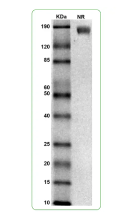 MW: Molecular Weight marker reduced condition
NR: CSF2Rα under non-reduced condition